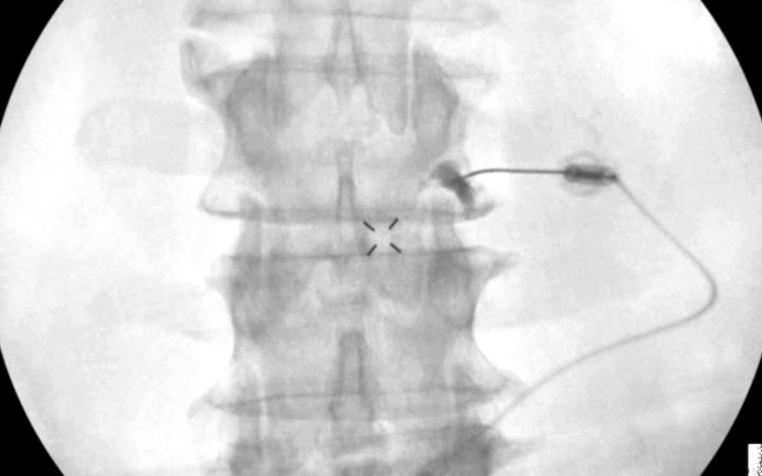 What is a Pain Medicine Specialist?