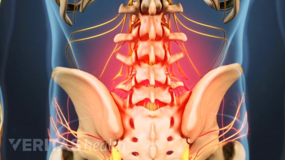 Is Your Lower Back Pain Serious?